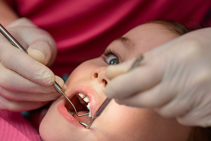 Seek dental care to prevent canker sores in kids
