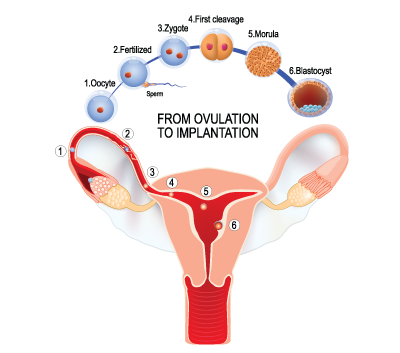 Implantation Chart