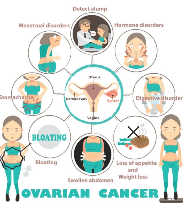 7 Symptoms Of Ovarian Cancer You Should Not Ignore