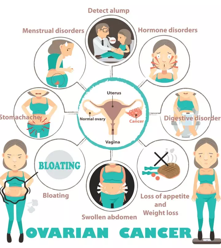 7-Symptoms-Of-Ovarian-Cancer-You-Should-Not-Ignore