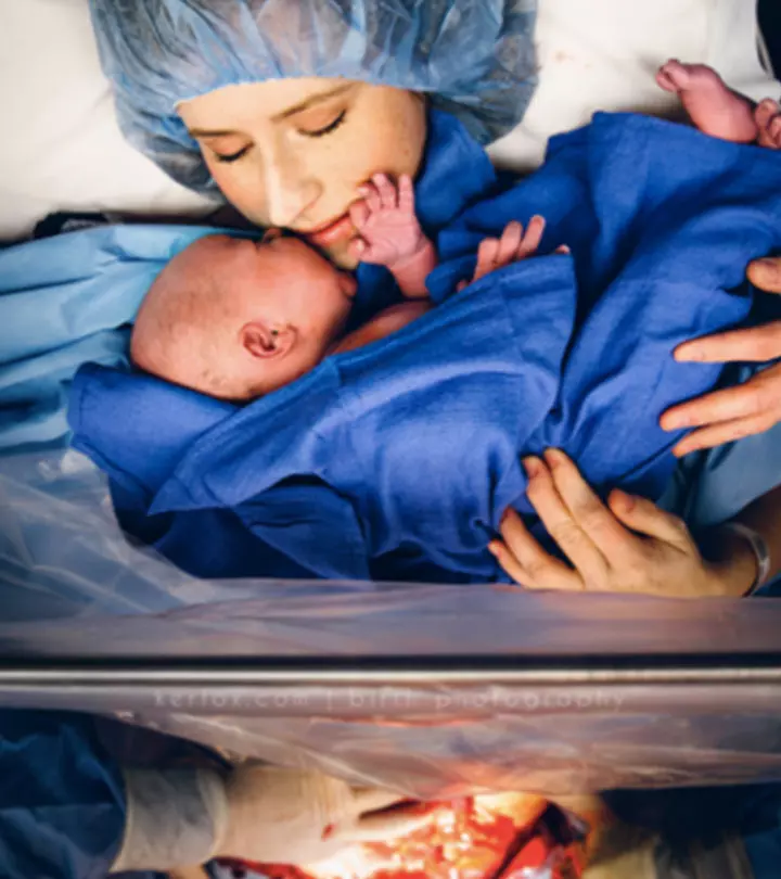 10 Intimate C-section Photos That Show How Strong Mothers Are