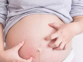 Itchy Skin During Pregnancy Could Be Dangerous For Your Baby