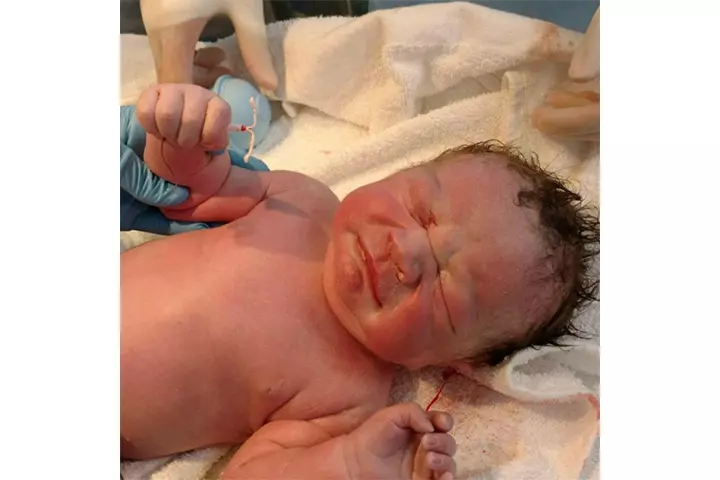 Mother Gives Birth And The Baby Comes Out With This