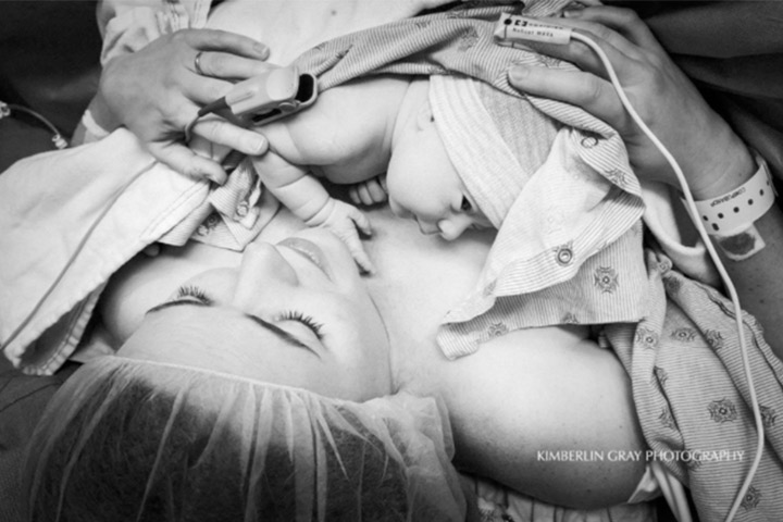 This photo shows a family-centered C-section birth