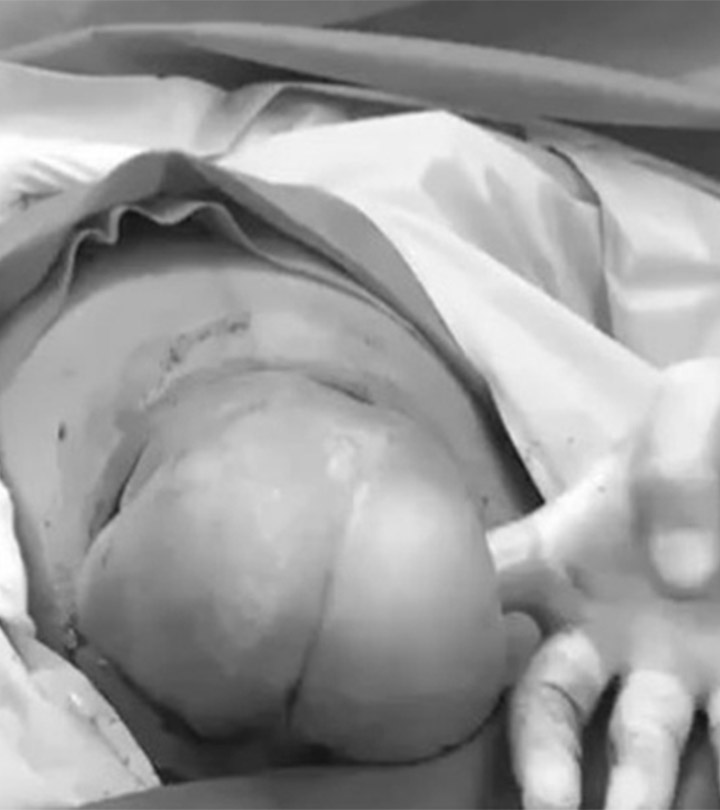 Watch The Most Miraculous C-Section Video Ever!