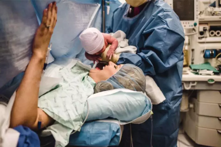 breathtaking shot of clear-drape cesarean section