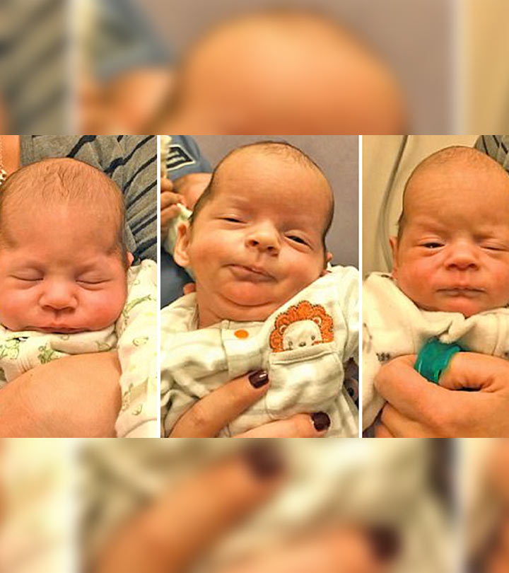 Mom Gives Birth To Triplets, Notices Their Heads Look Odd