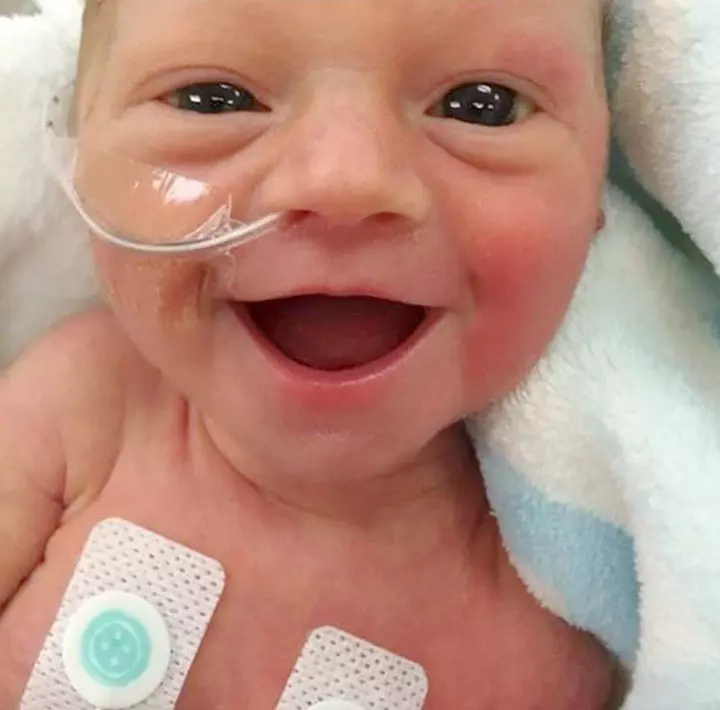 Premature Baby Girl Smiling 5 Days After Birth1