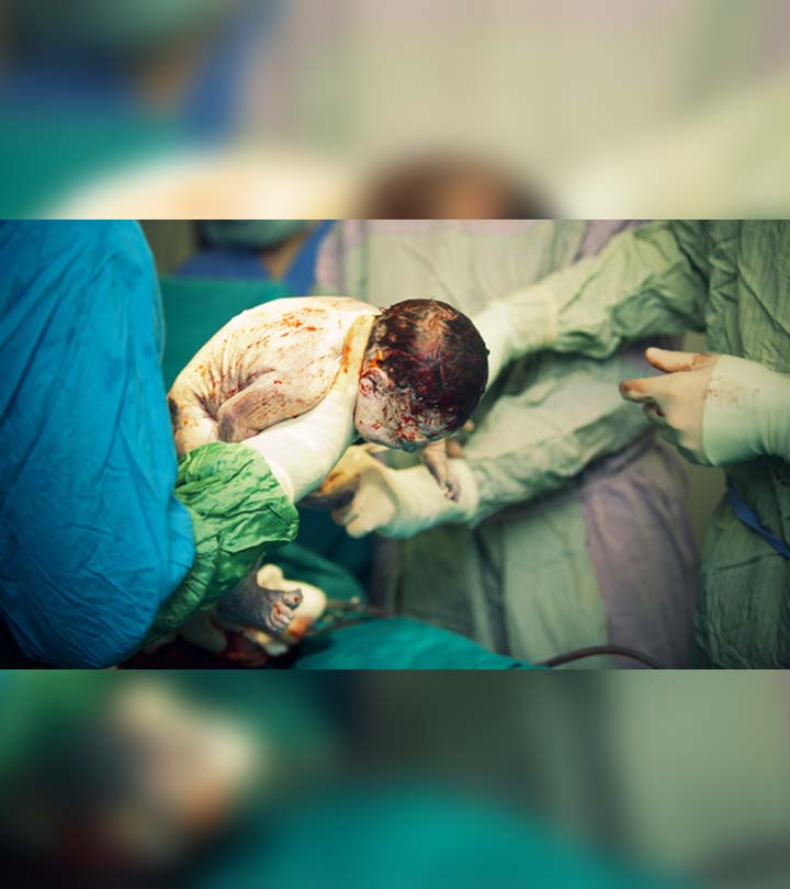 Stunning C-Section Photo Sums Up The Magic Of Childbirth