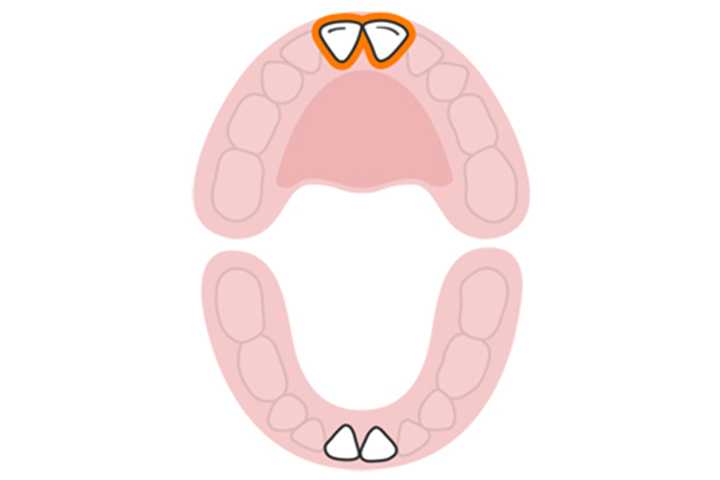 The central incisors (upper)