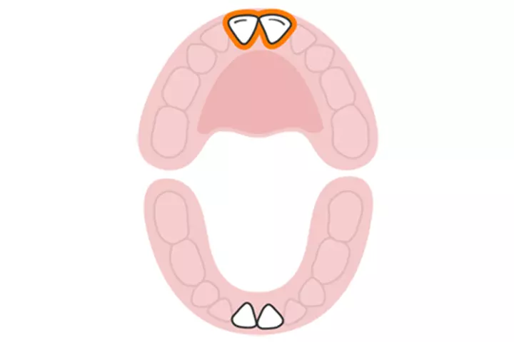 The central incisors (upper)