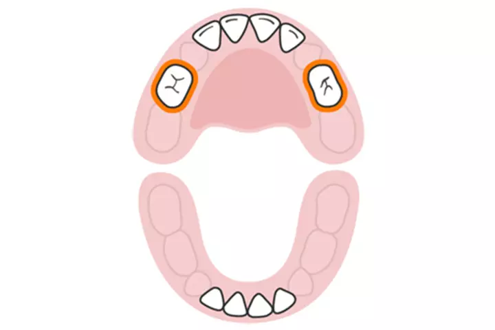 The first molars (upper)