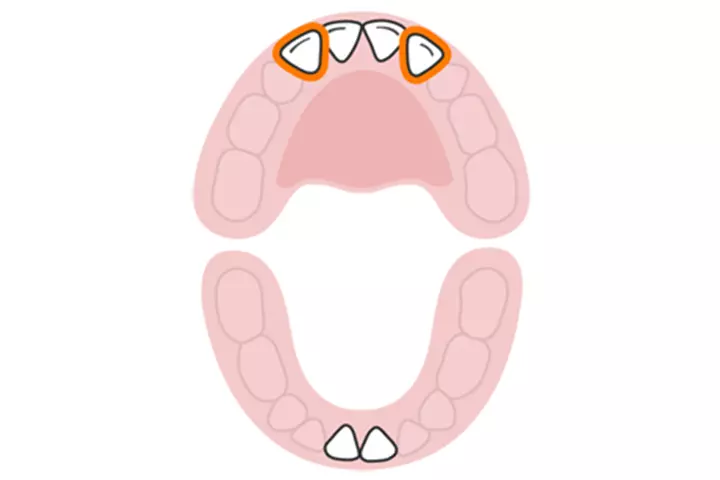 The lateral incisors (upper)