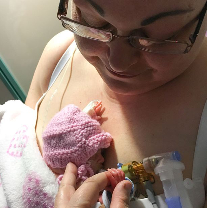 This Premature Baby Is A Miracle1