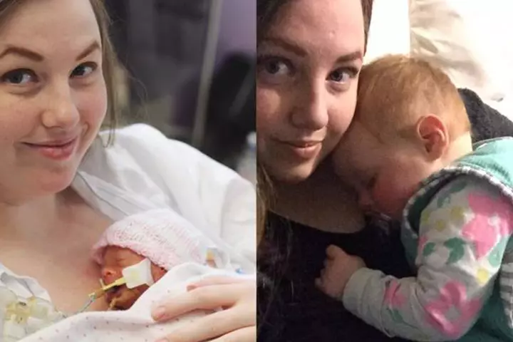 This before and after picture of baby Pearl says it all