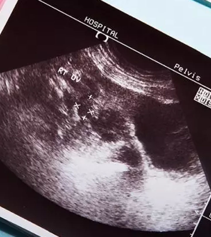 母亲的怀孕测试是积极的。什么医生See Is ‘Grapes’ Instead Of Baby