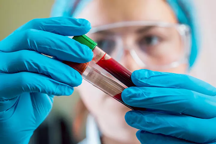 Abnormal AFP levels alert! Abnormal AFP levels alert!