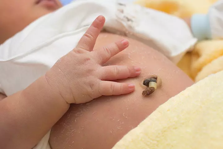 Tampering with the umbilical cord
