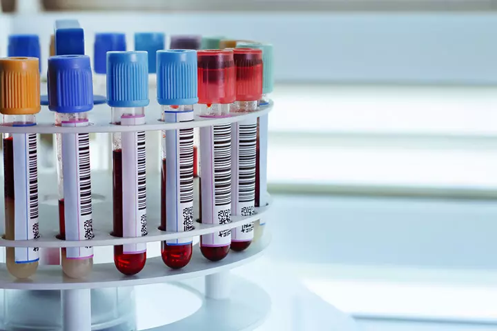 Cord blood banking