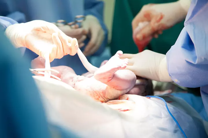 Take the placenta and umbilical cord into account