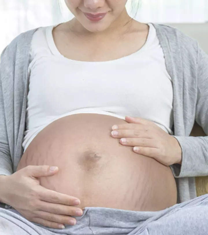 4 Signs That Show You Will Get Stretch Marks During Pregnancy