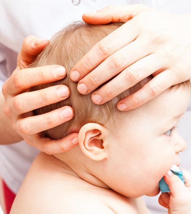 Flat Head Syndrome In Babies: 4 Ways To Prevent It