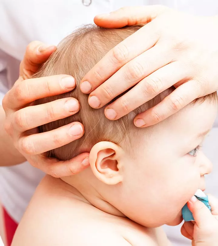 Flat Head Syndrome In Babies 4 Ways To Prevent It