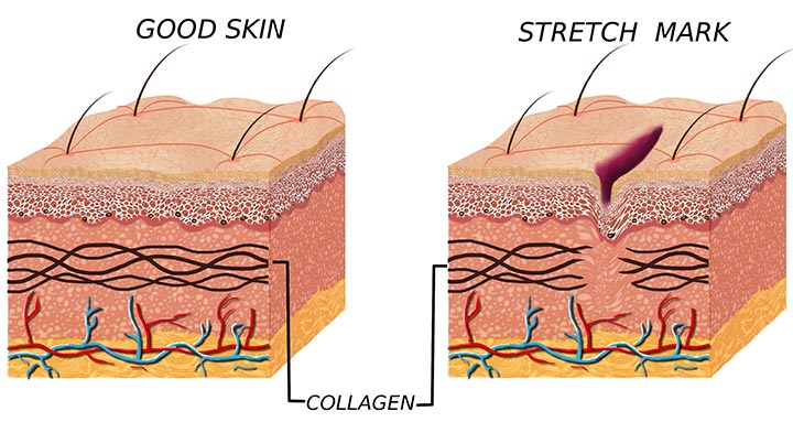 The Basic Biology Of Skin