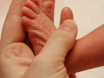 Treating Your Baby's Dry Skin: A Paediatrician Explains