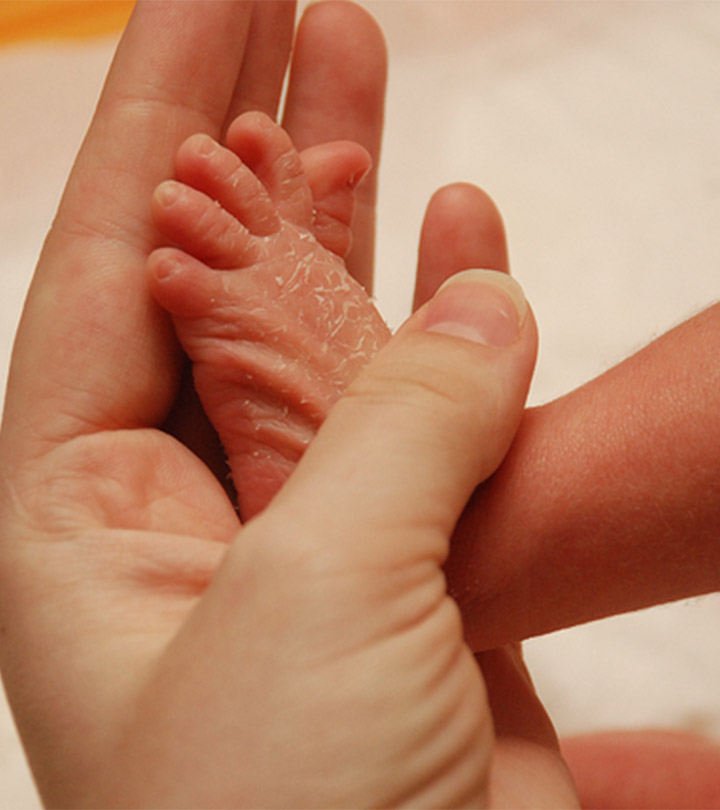 Treating Your Baby's Dry Skin: A Paediatrician Explains