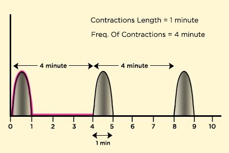 Labour Contractions Timing Chart