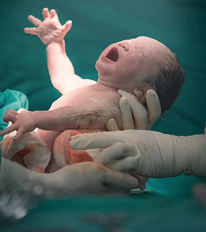Gentle Caesarean A New Approach To C-Sections