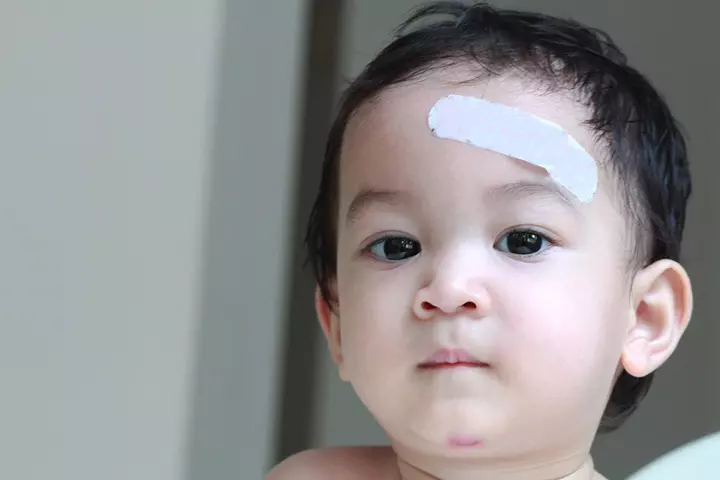 Using Alcohol To Treat A Wound