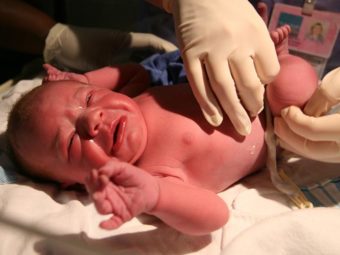Watch: Why 39 Weeks Of Gestation Before Induced Labor?