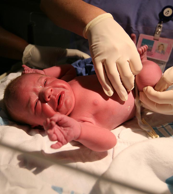 Watch: Why 39 Weeks Of Gestation Before Induced Labor?