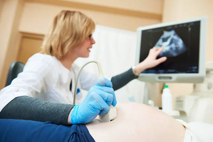 Large Head Circumference During Ultrasounds