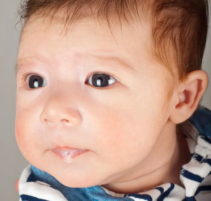 Spitting Up Versus Vomiting