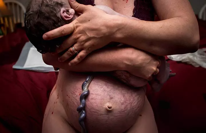 Photographer Captures Newborns Still Attached to Umbilical Cords