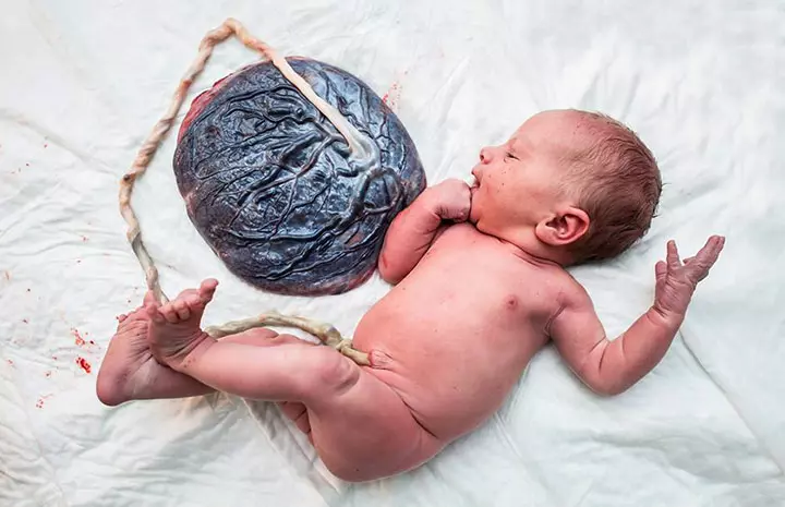 Photographer Captures Newborns Still Attached to Umbilical Cords