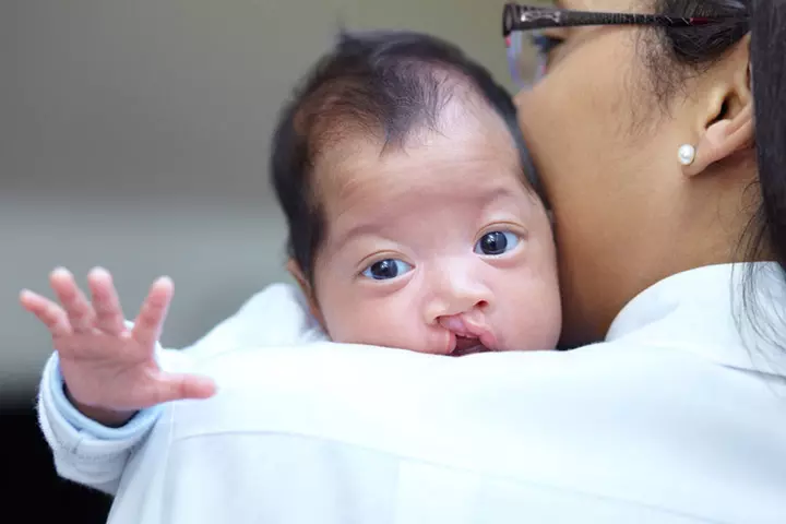 Natal teeth may be common in infants with cleft lip and cleft palate