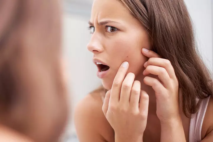 Breaking Pimples