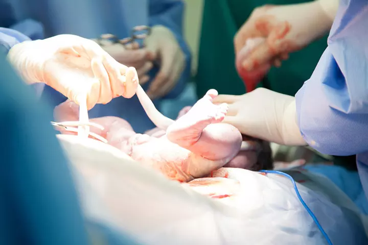 What Is Lotus Birth And How Does It Work