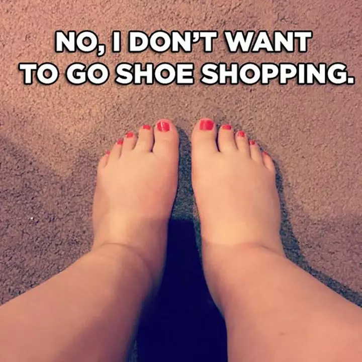 Swollen Feet