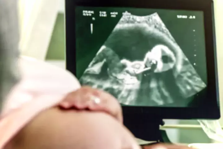 Placental Abruption