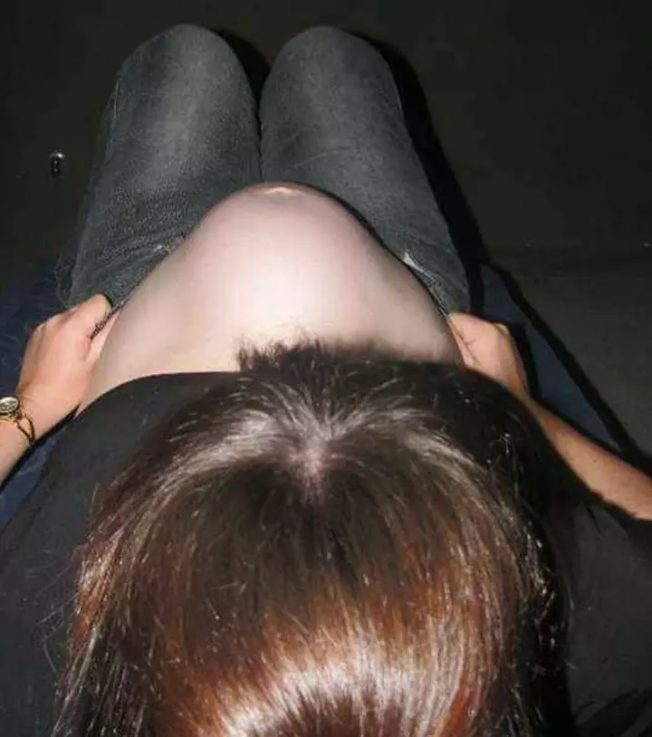 This Is What It Can Mean When Baby Bumps Turn into a 'Cone'3