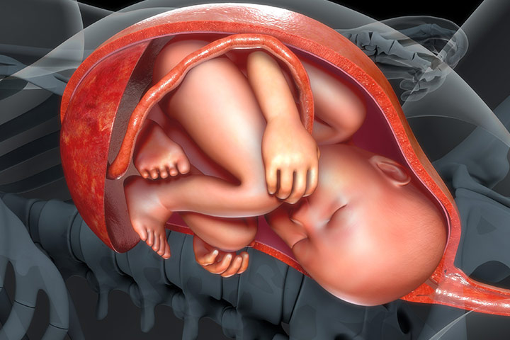 Placenta Abruption