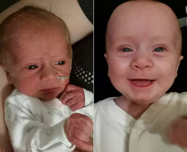 The Best Before And After Pic!