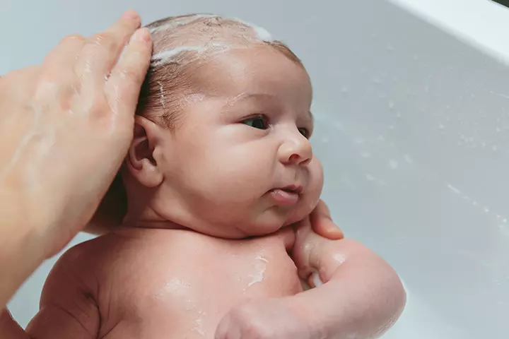 Treat The Cradle Cap Right