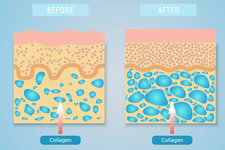 What are the benefits of collagen