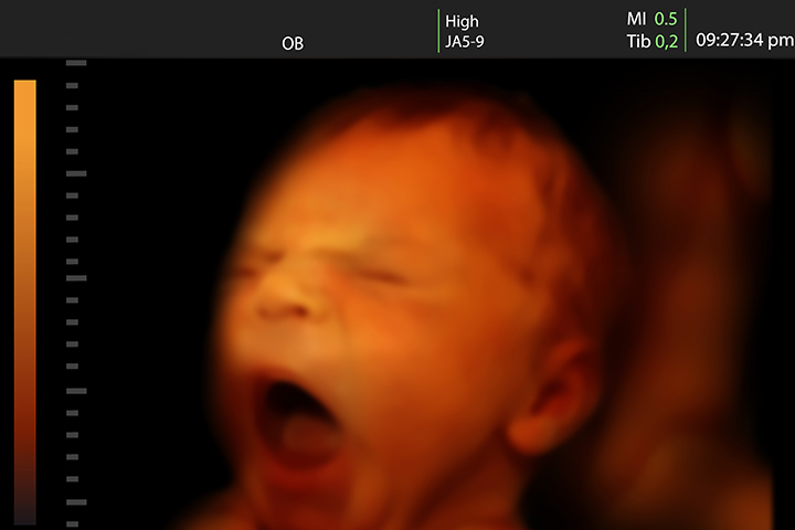 Yawning In The Womb